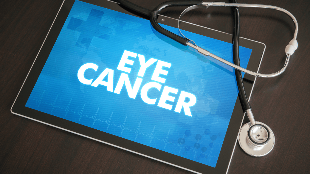 Understanding Eye Cancer & What You Can Do AbellEyes Refractive Solutions