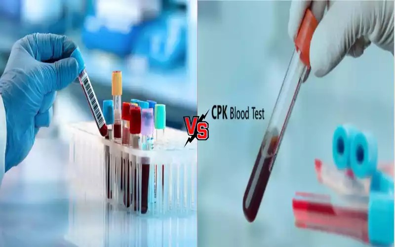 CK and CPK Blood Test Best 12 Difference