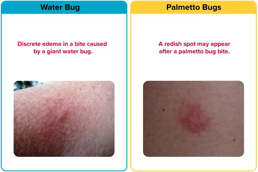 Palmetto Bug Vs. Water Bug [15 Differences] APB