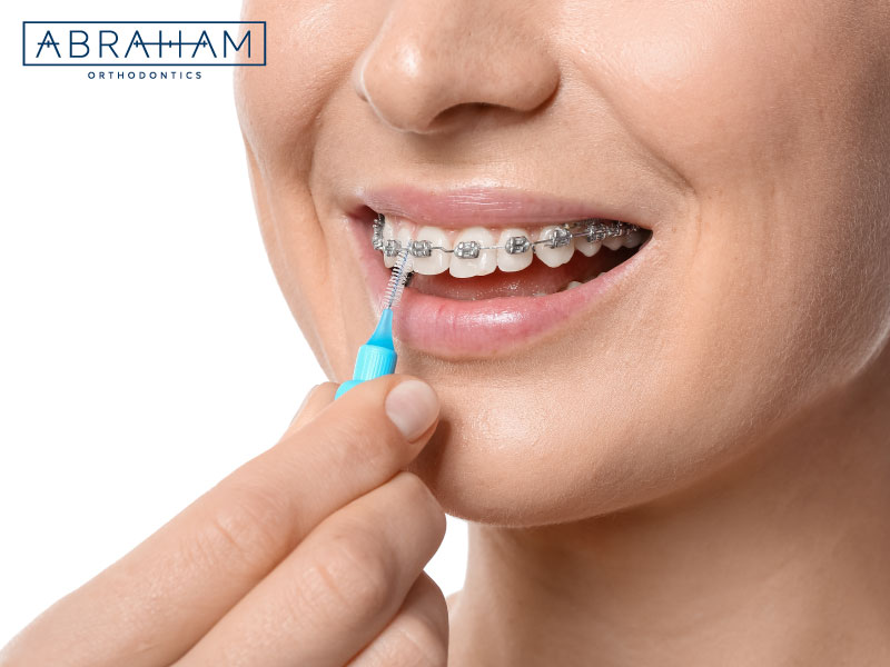 What Are Some Dental Hygiene Tips for Patients With Braces? Abraham