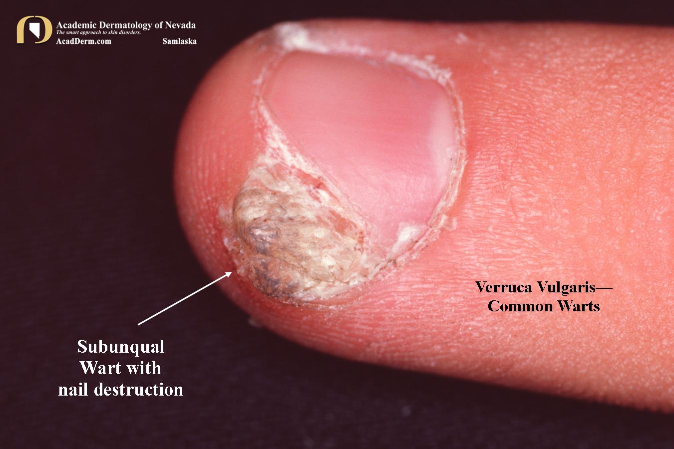 Academic Dermatology of Nevada