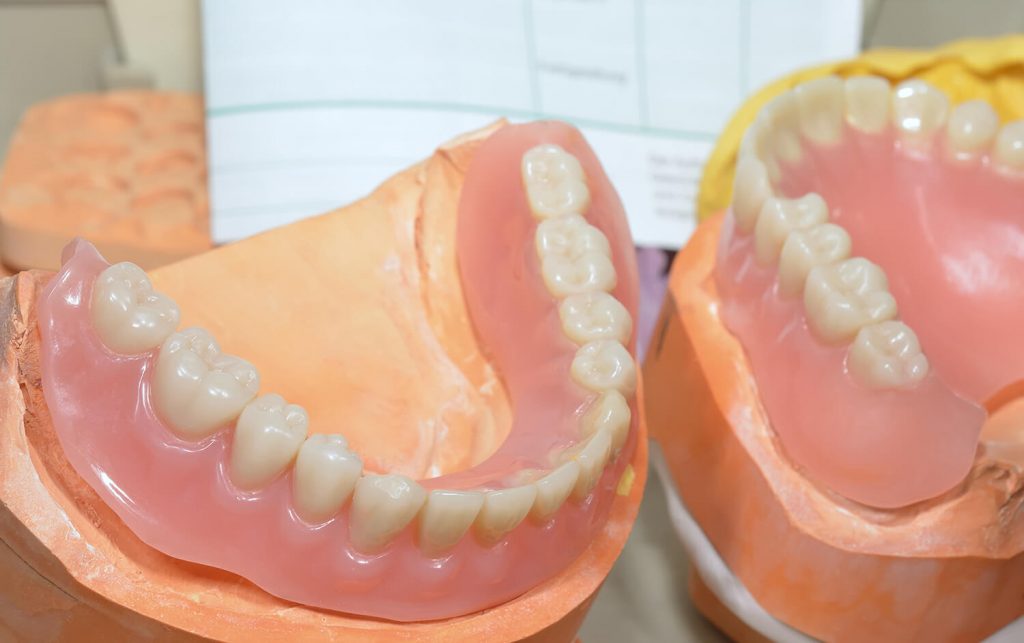 What Happens When Your Dentures Dry Out? Accent Denture Services