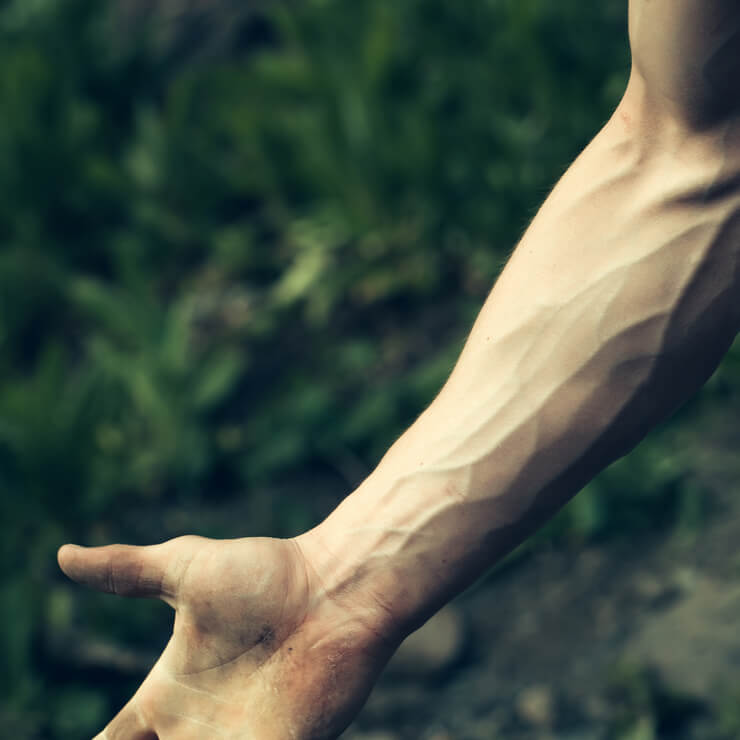 Visible Veins Appearance Care Center