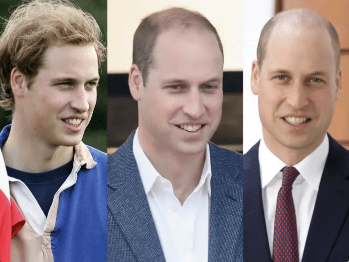 Why Asians look younger than white people? Academie de Bernadac