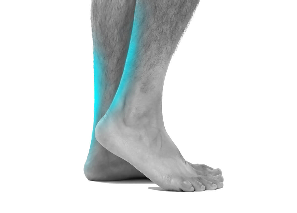 Achilles Tendonitis / Tendinosis / Enthesopathy ACE Podiatry
