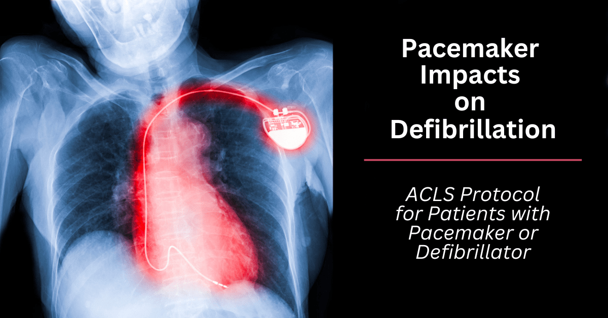 Pacemaker Impacts On Defibrillation Advanced Certification Institute