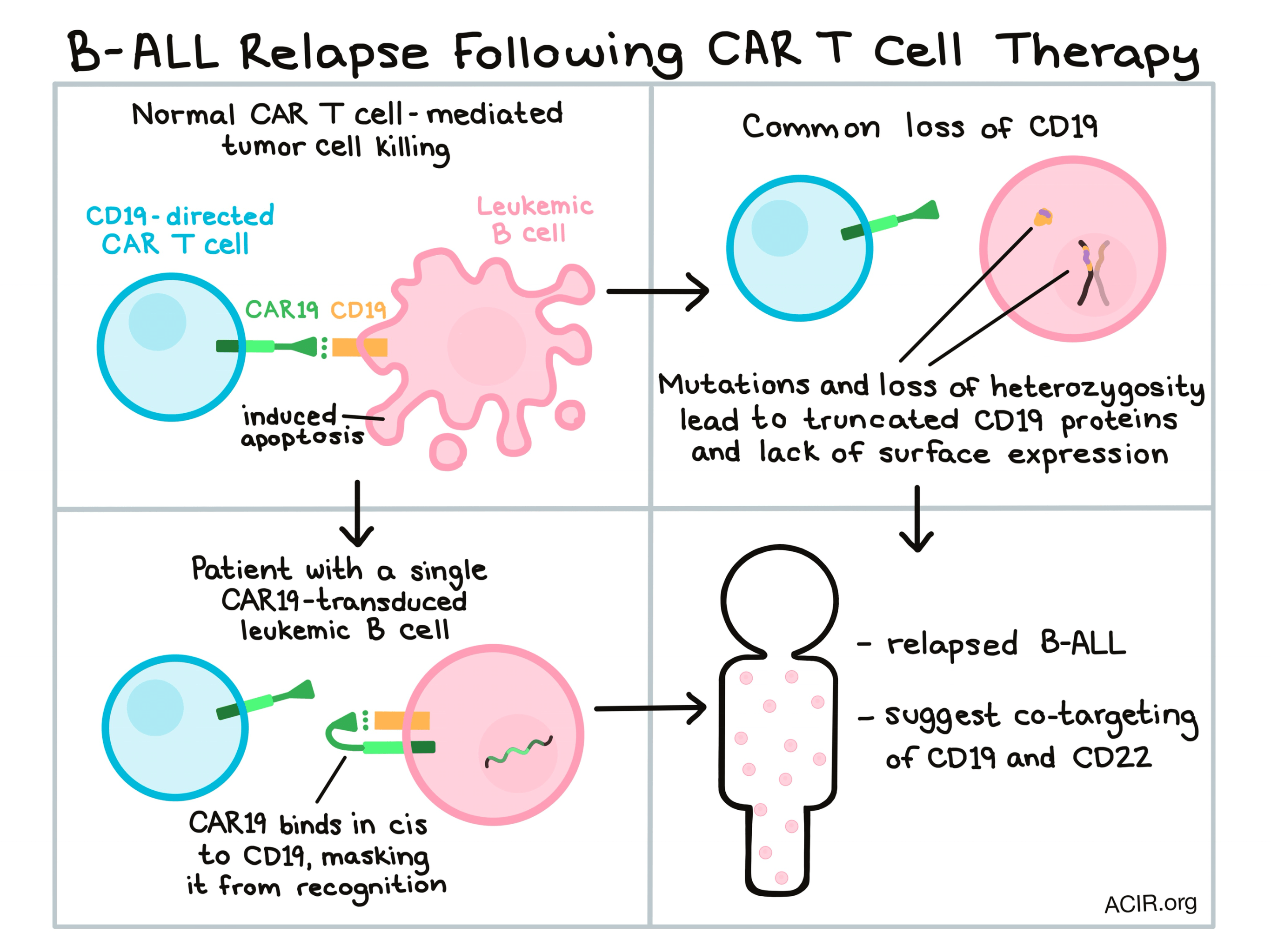 When CAR T cell therapy crashes