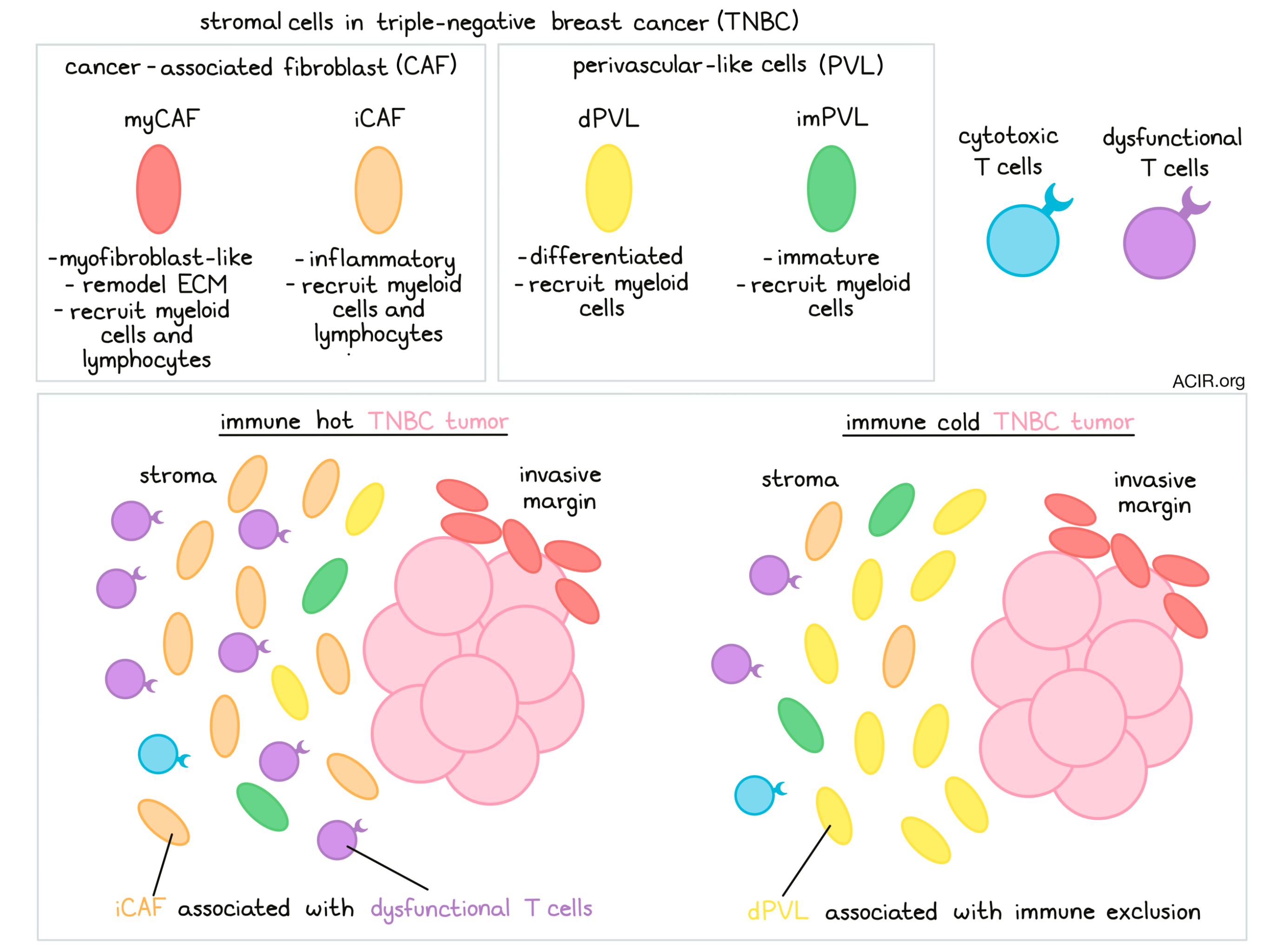 Stromal cells affect immune infiltrate in triplenegative breast cancer