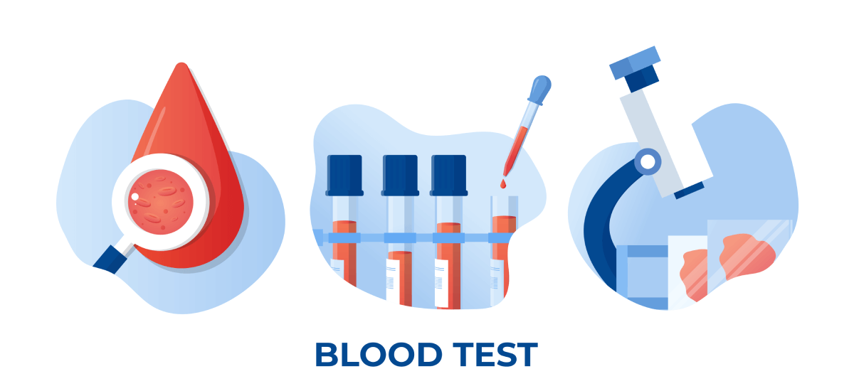All you need to know about MCHC Blood Tests Types & Methods