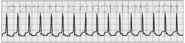 Image De Svt - Get Images Two