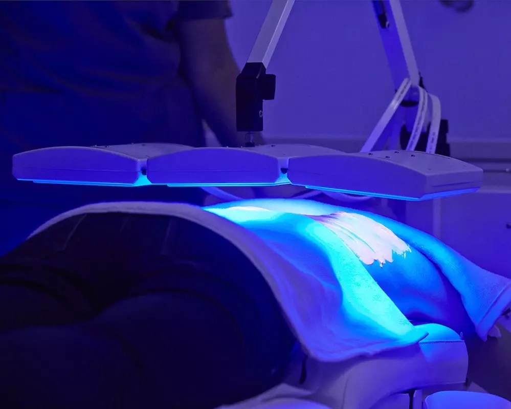 Shining a light on acne therapies All About Acne