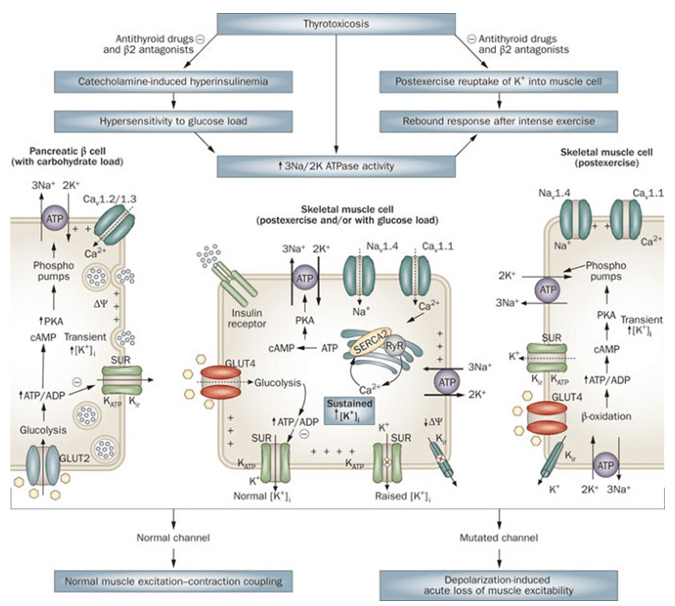 Hypokalemic Periodic Paralysis Creative Bioarray
