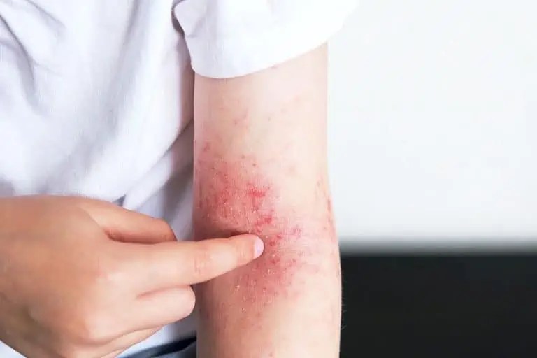 Is Pen Ink Bad for Your Skin? Writing on Your Skin With Pen