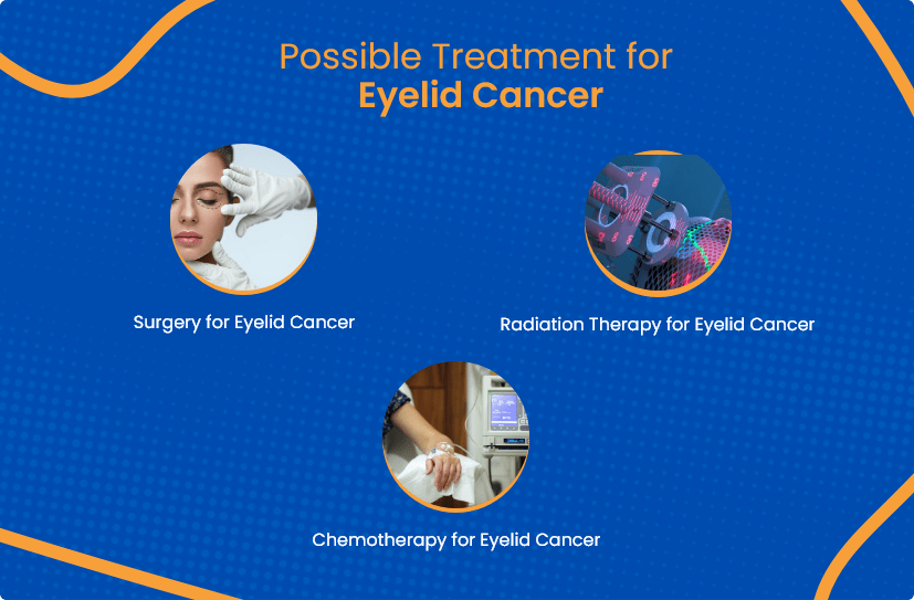 Eyelid Cancer Everything You Need To Know ACTC