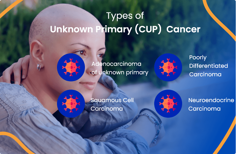Unknown Primary Cancer (CUP) Everything You Need To Know
