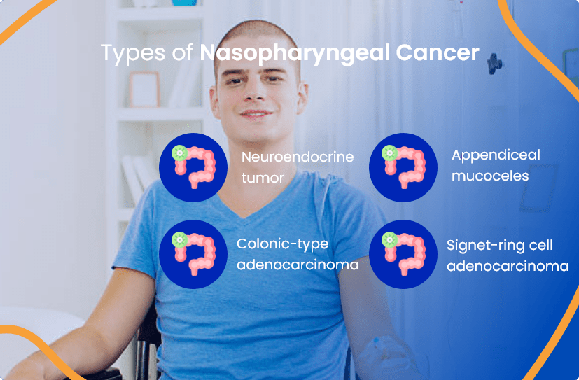 Appendix Cancer Everything You Need To Know ACTC