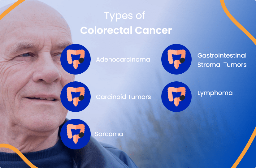Colorectal Cancer Everything You Need To Know ACTC