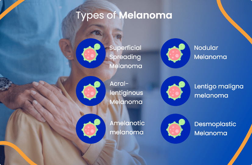 Melanoma Treatment Everything You Need To Know ACTC