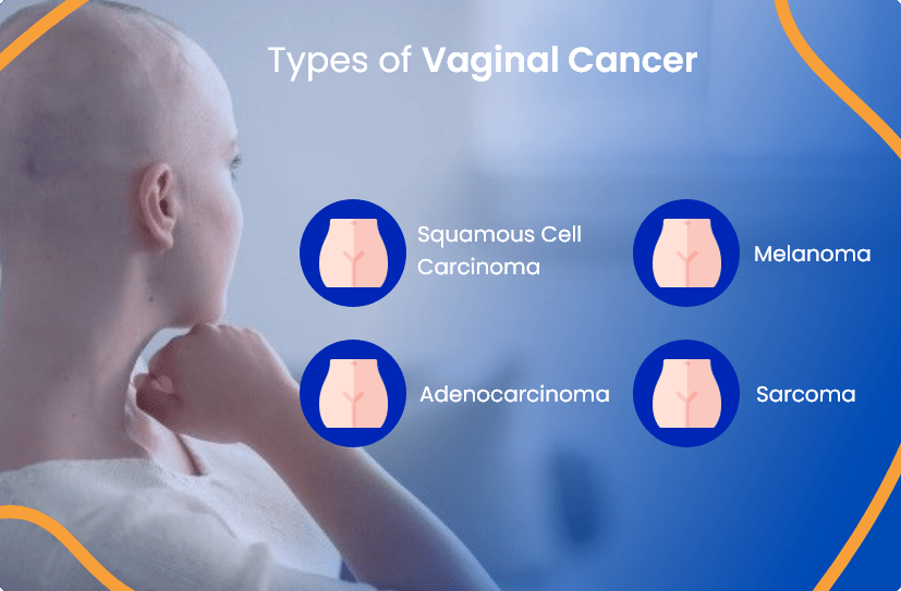 Vaginal Cancer Everything You Need To Know ACTC