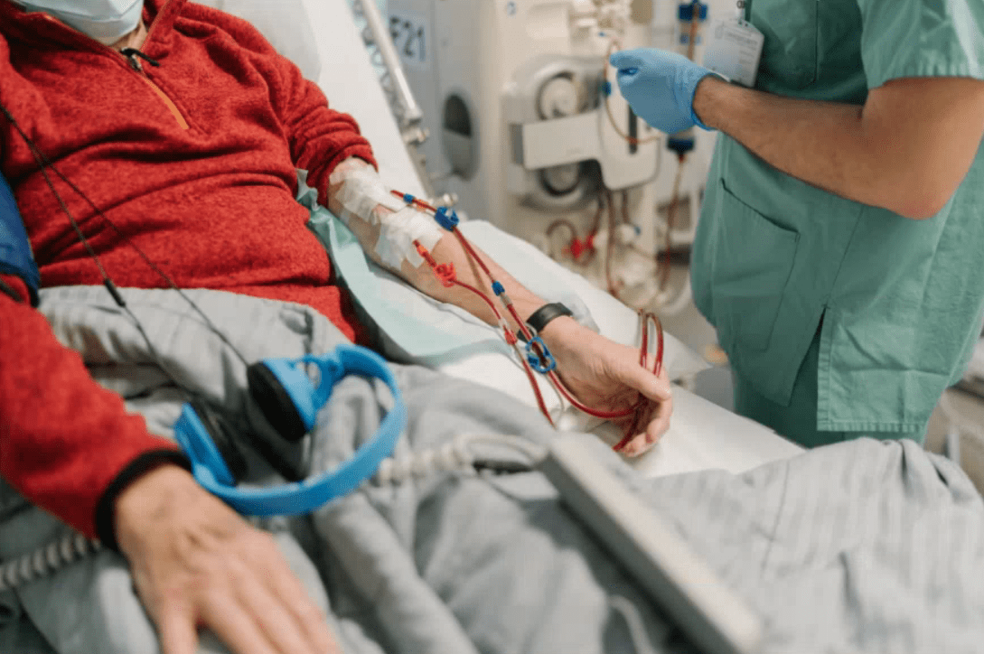 Hémodialyse qu'estce que le cathéter de dialyse