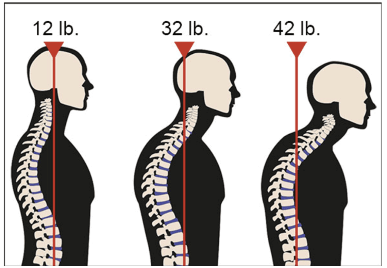 Best Neck Pain Solutions Text Neck Posture Secrets Home Fitness Solutions