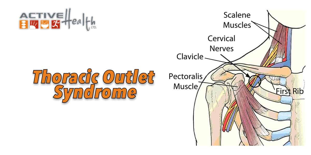 Thoracic Outlet Syndrome Chiropractor Park Ridge, IL Active Health