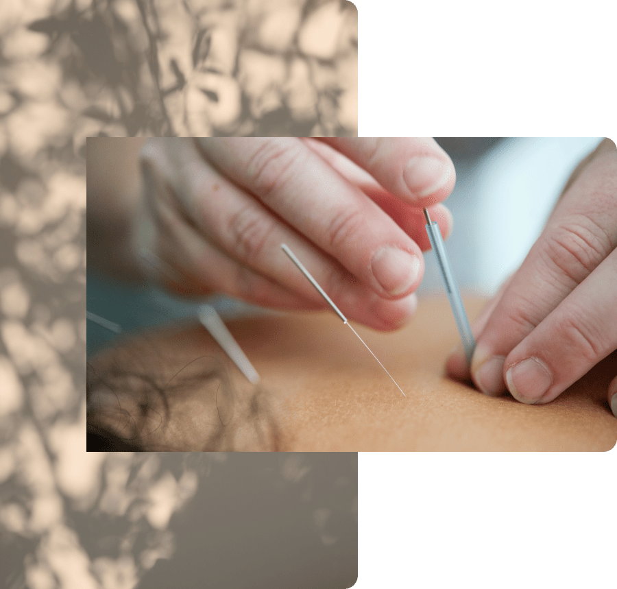 Physio and Sport Therapy in Vancouver