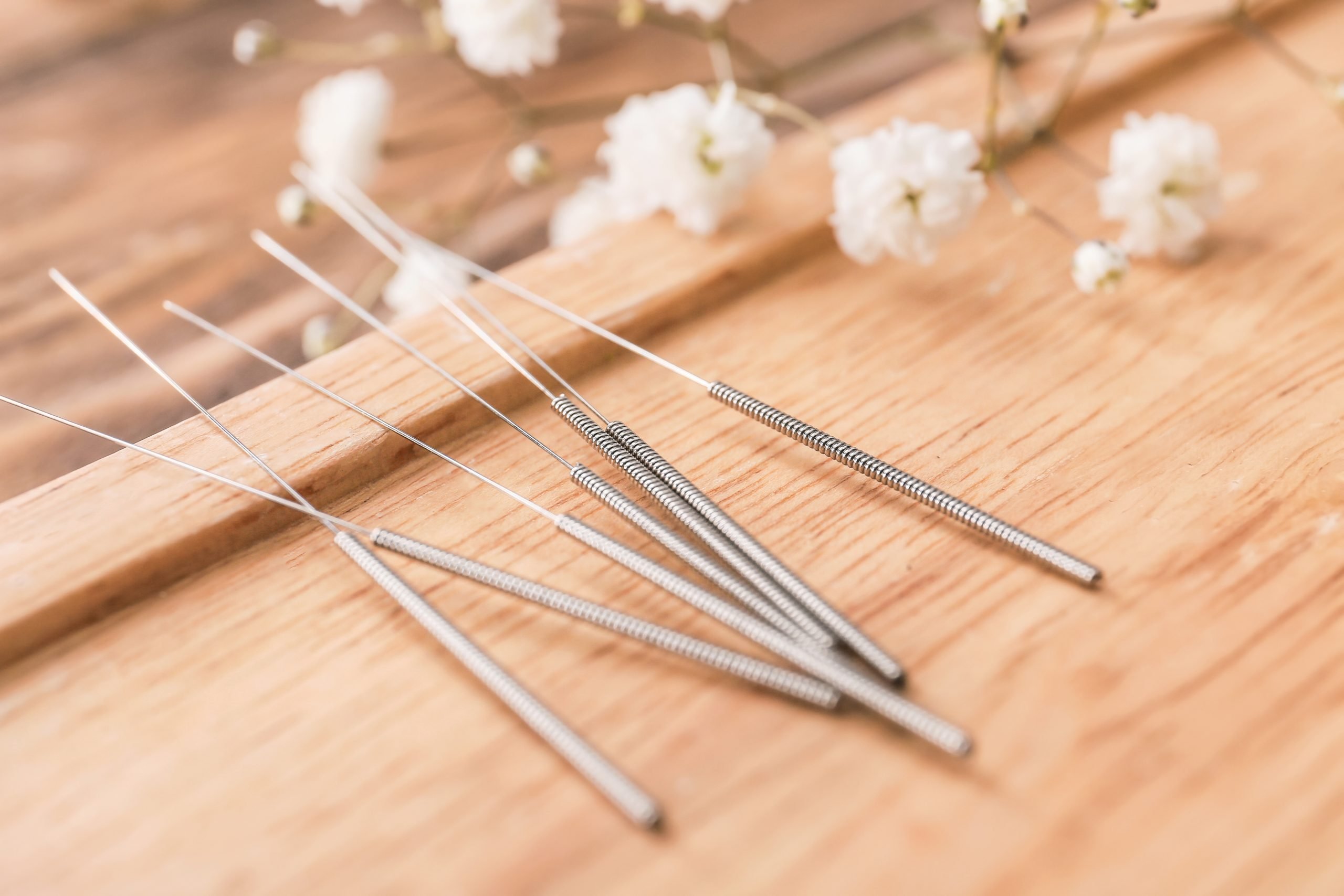 10 Proven Ways Acupuncture Tackles Chronic Pain Here's What to Expect