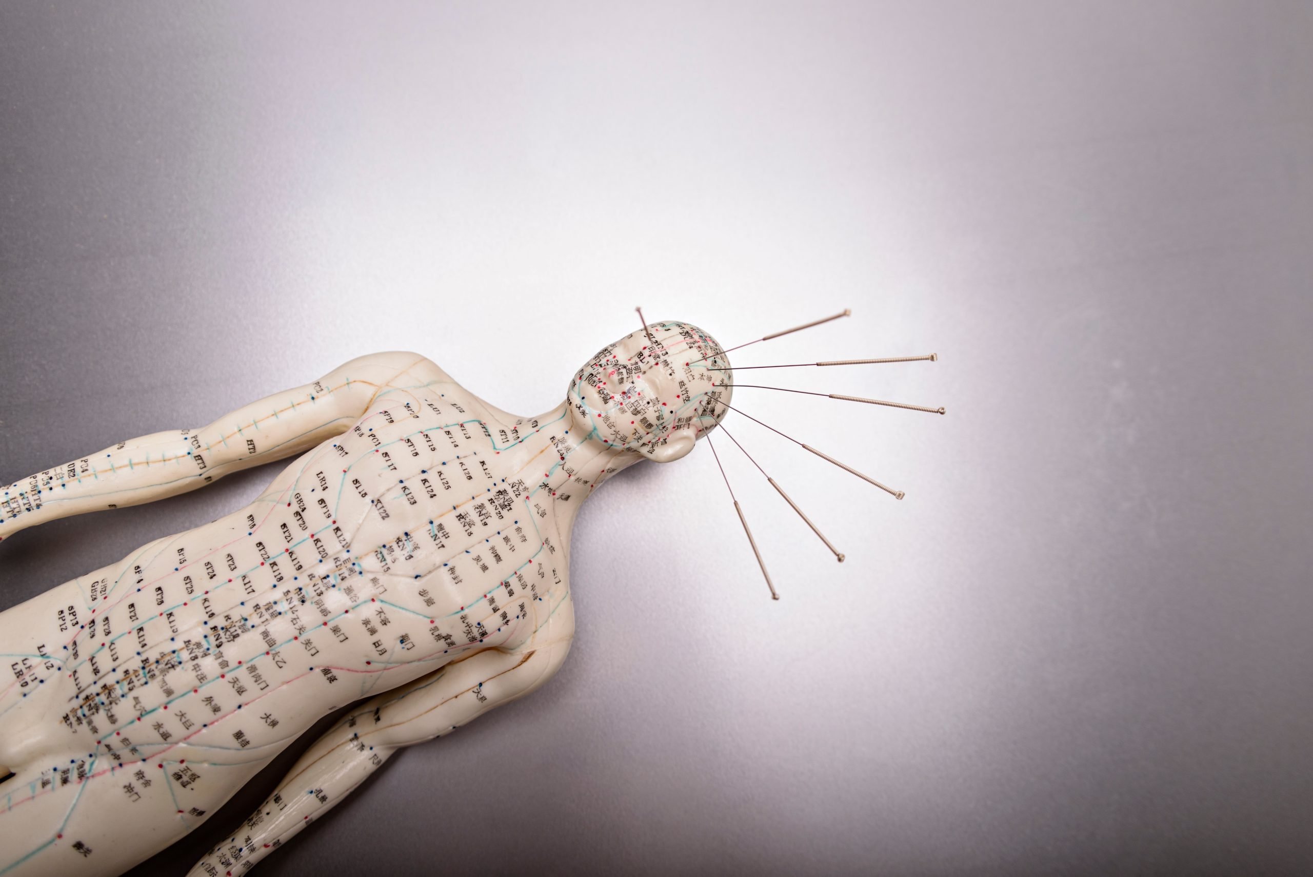 10 Proven Ways Acupuncture Tackles Chronic Pain Here's What to Expect