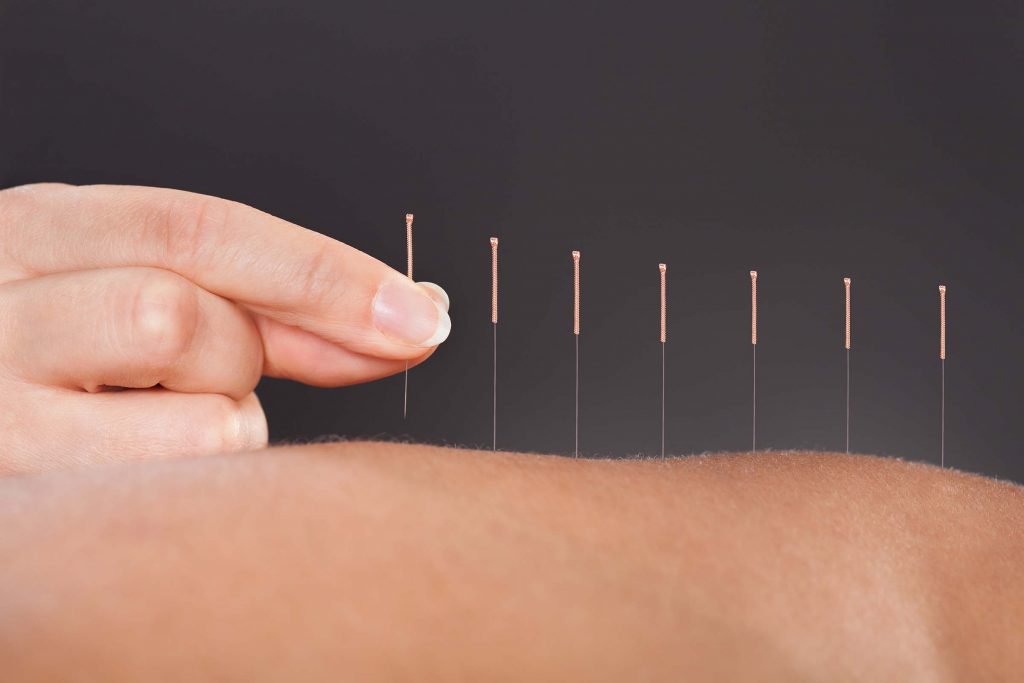 Acupuncture Works Acupuncture & Remedial Massage Treatment. Massage Therapist Training CPE