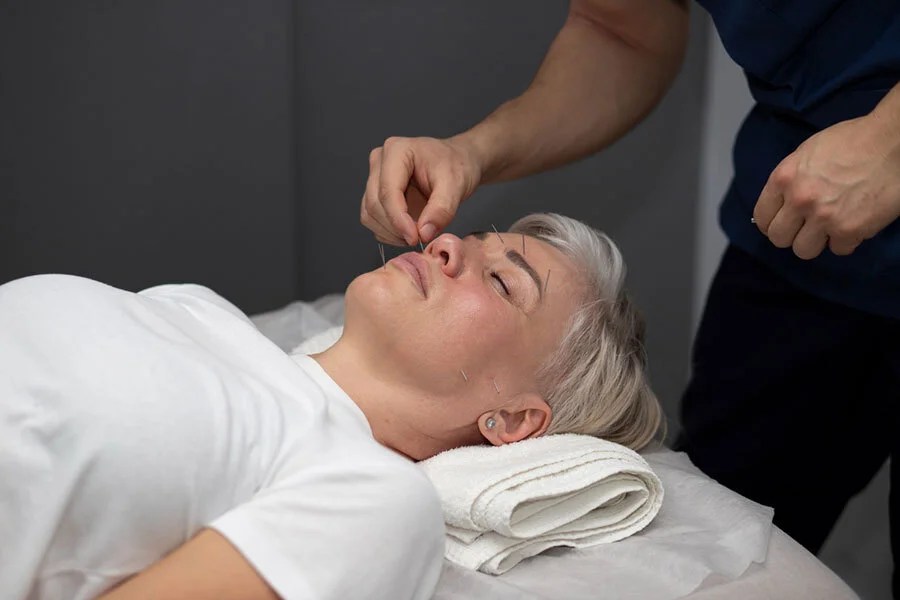 Treating Depression Exploring The Benefits of Acupuncture