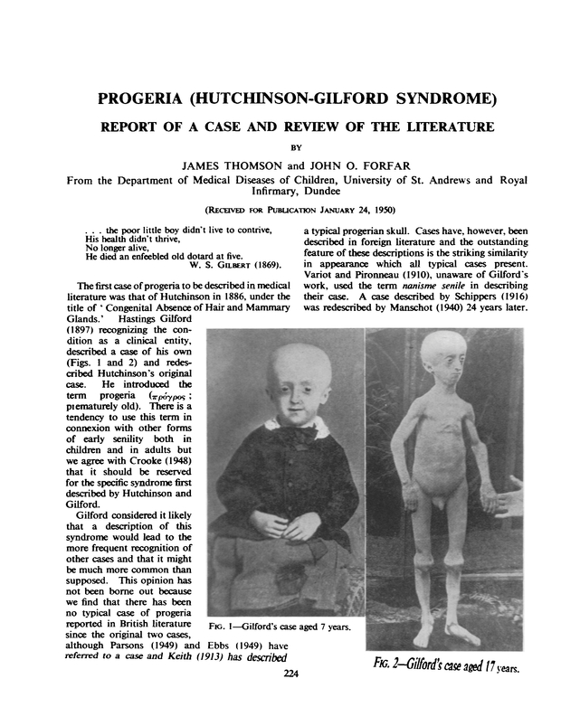 Progeria (HutchinsonGilford Syndrome) Archives of Disease in Childhood