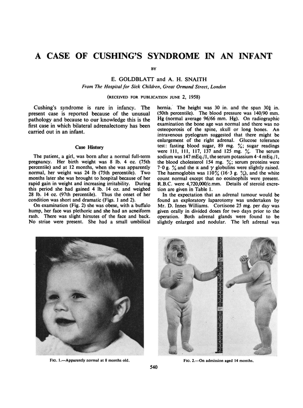 A Case of Cushing's Syndrome in an Infant Archives of Disease in