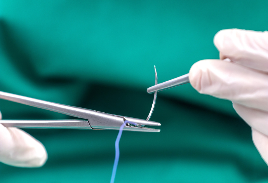 Sutures and Staples How do doctors choose between them? Add More to