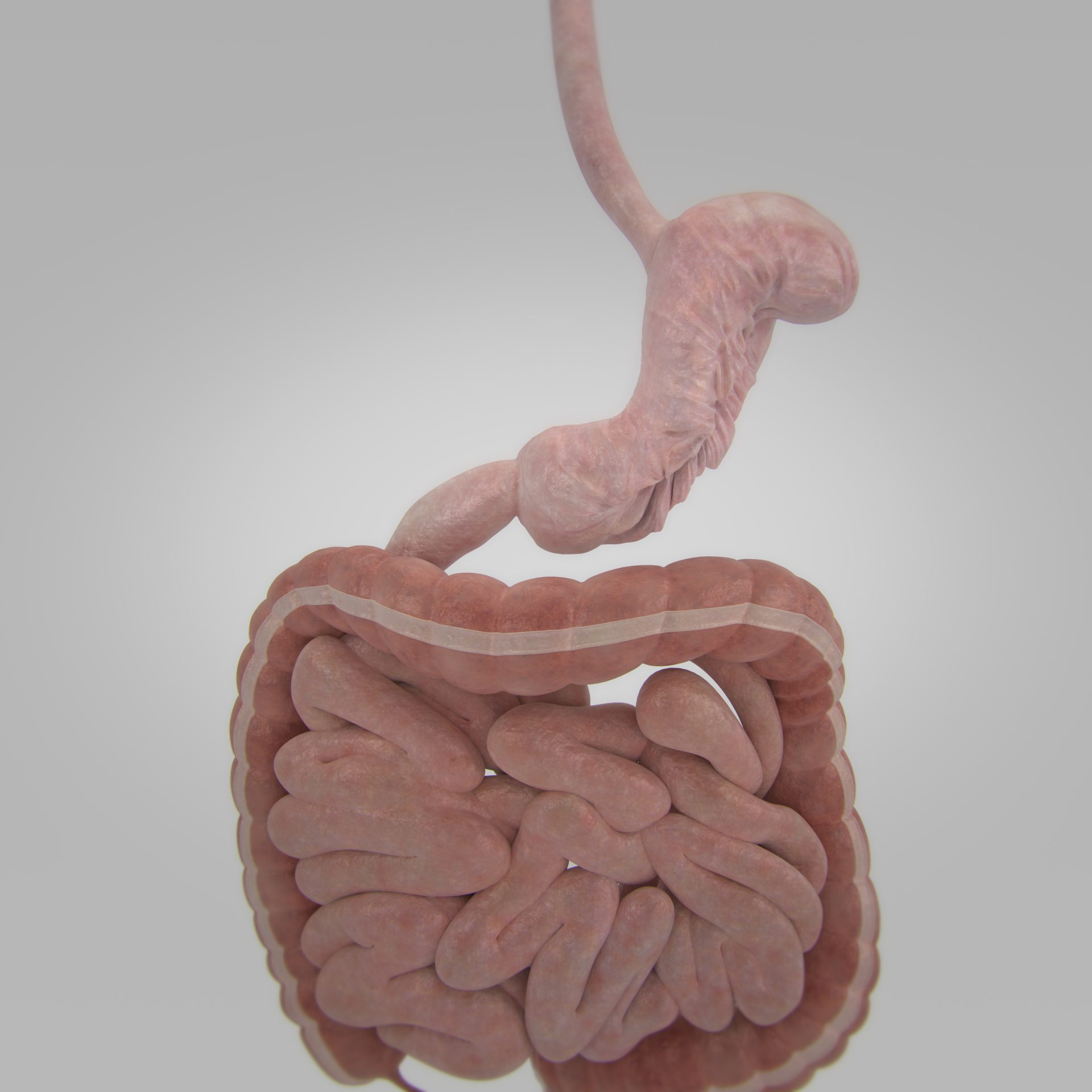 Endoscopic sleeve gastrectomy Adelaide Bariatric Centre