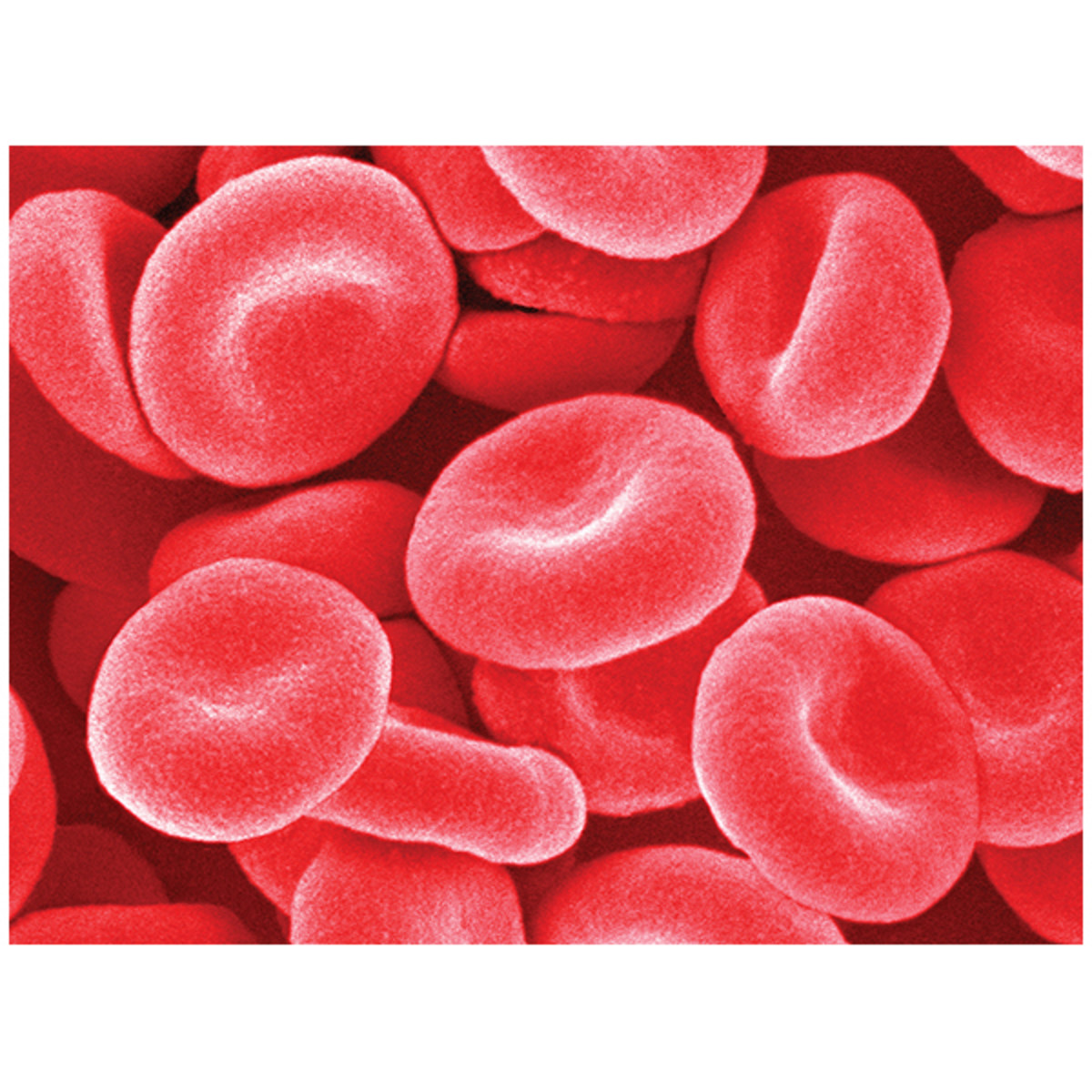 Classroom Kit Forensic Blood Typing For 10 Groups ADIA Inc.
