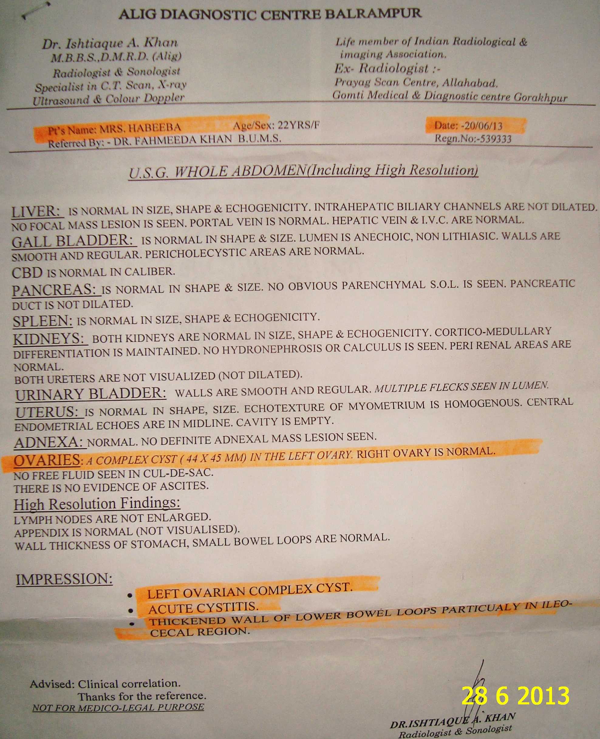 Complex Ovarian cyst vanished completely in 1 months. Case Study