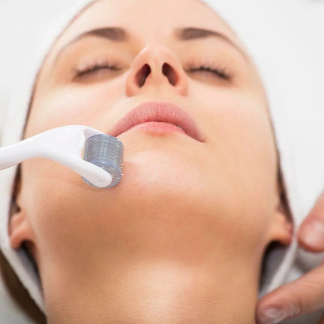 Why Microneedling is Not Safe to Do at Home ADM Skin Clinic