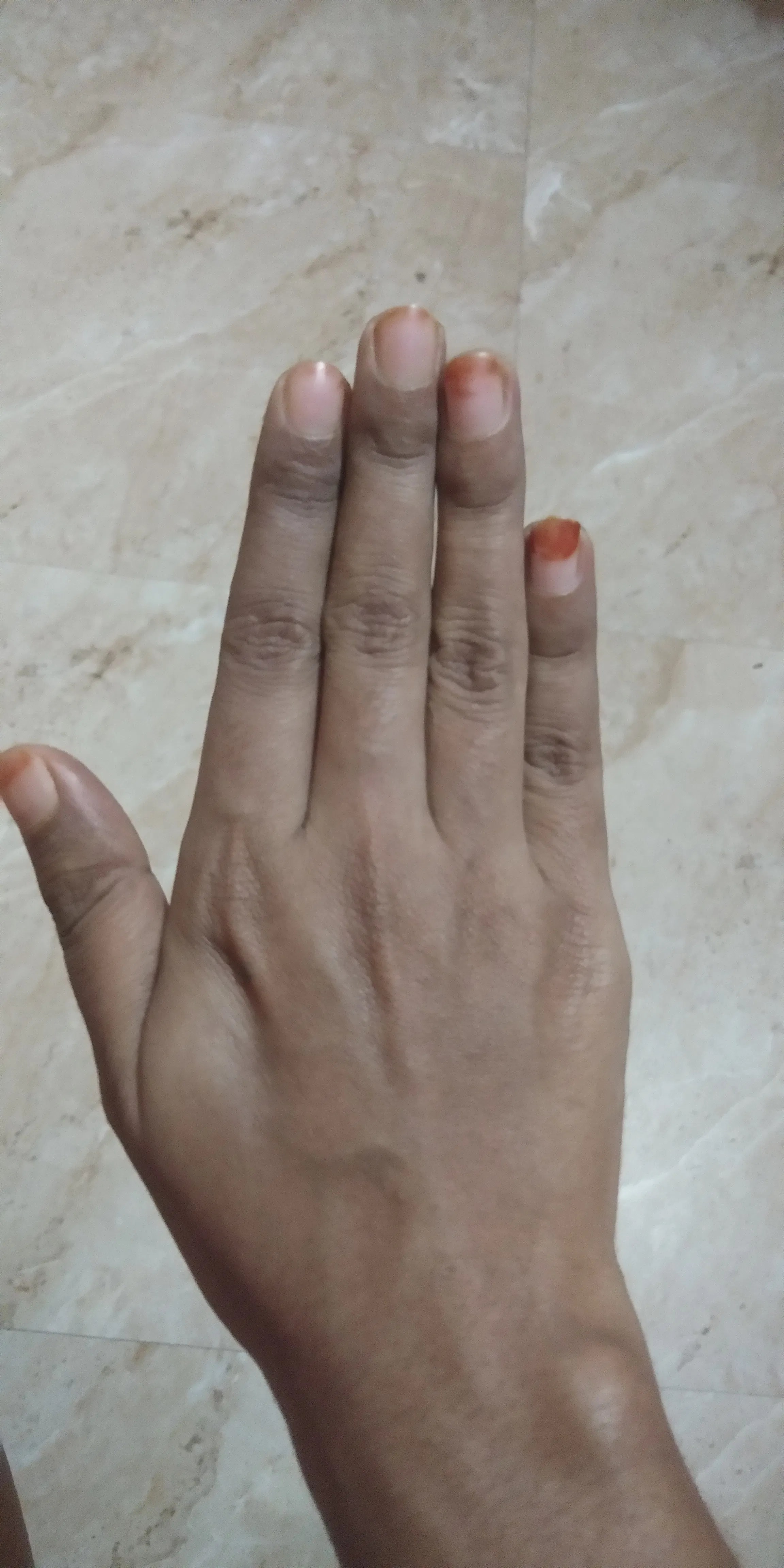 I have fine lines on my hand's fingers, so whatt should I do? Nykaa