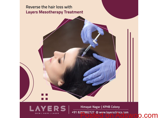 Best Mesotherapy treatment for hair loss Hyderabad Layers Clinics