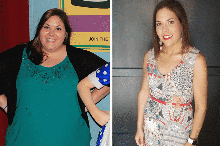 Gastric Sleeve success story [Sarah lost 160 lbs!] Advanced Bariatrics