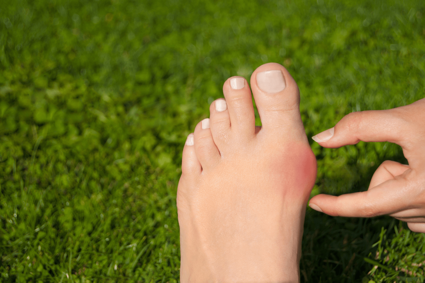 All About Bunions Advanced Ortho and Spine