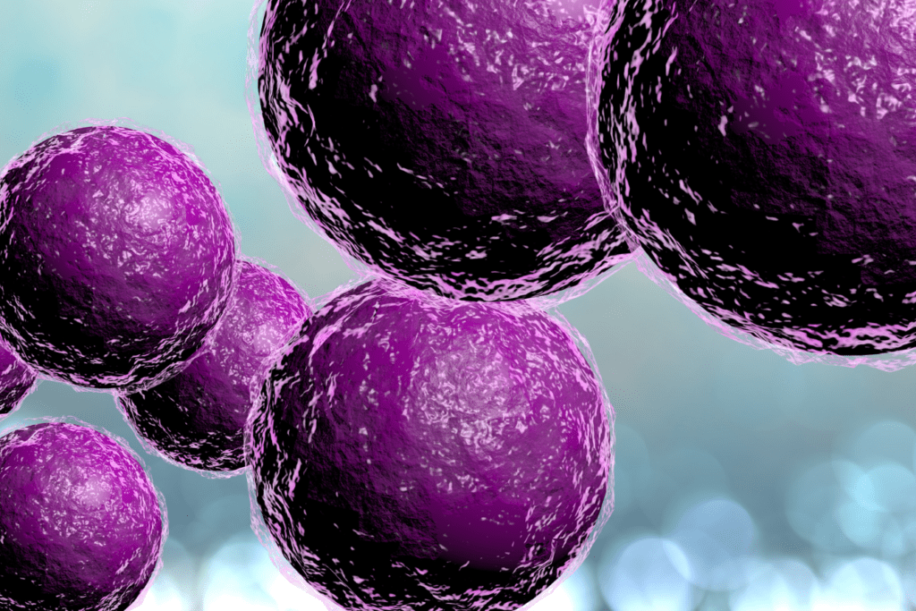 All About Prosthetic Joint Infections Advanced Ortho and Spine