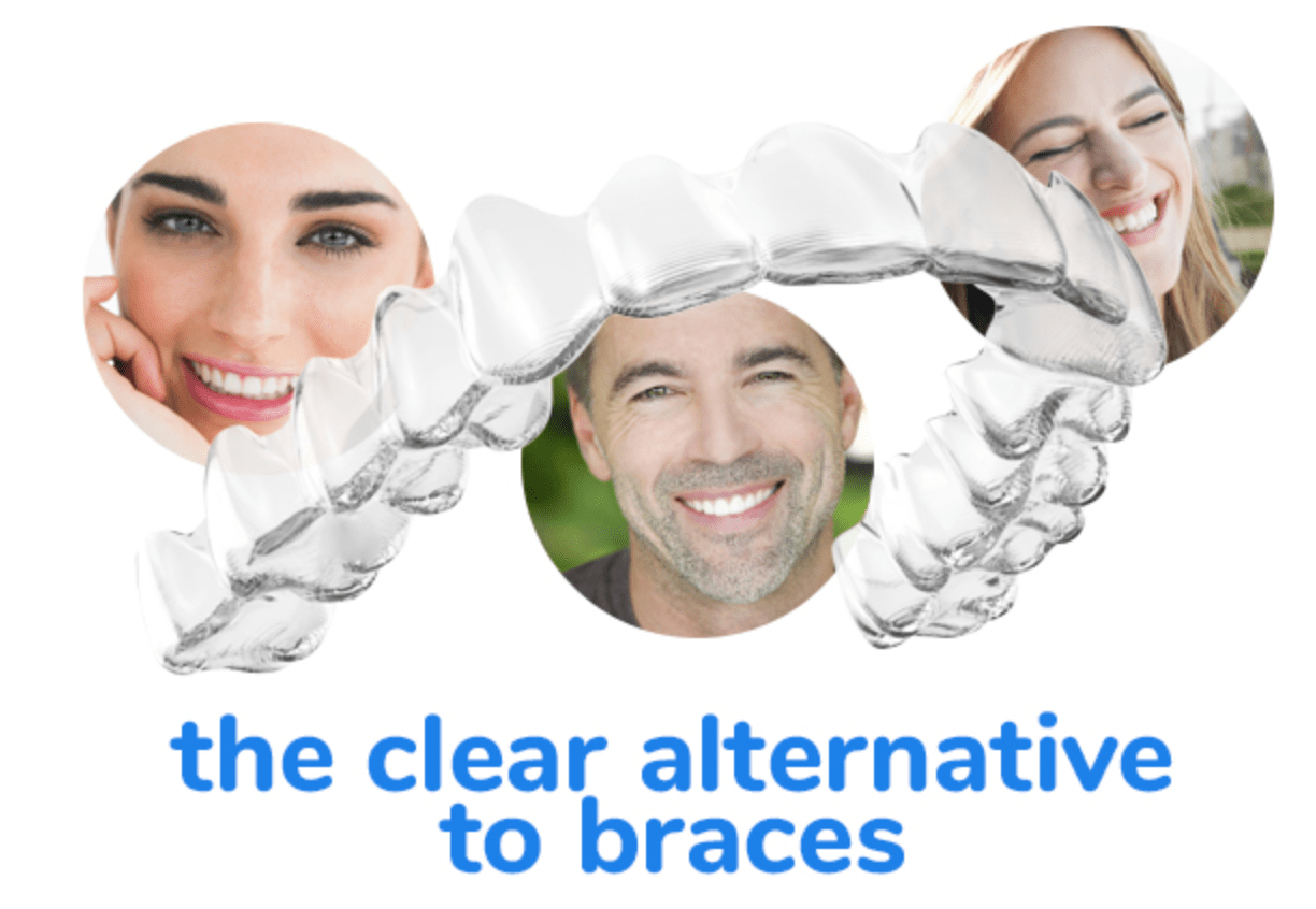 Achieve your best smile with Invisalign Advanced Smile Care