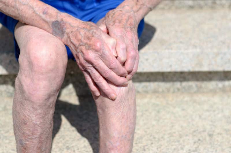 I injured my varicose vein over my knee, what should I do? Varicose