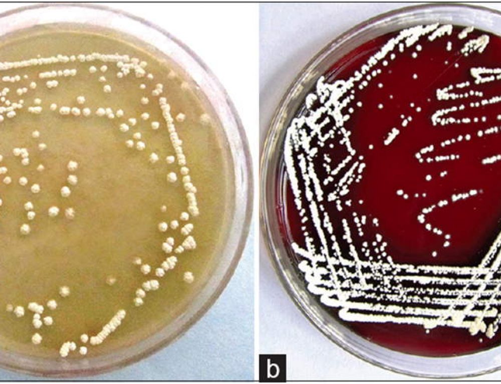 Chocolate Agar Know Your Media Advancells Group
