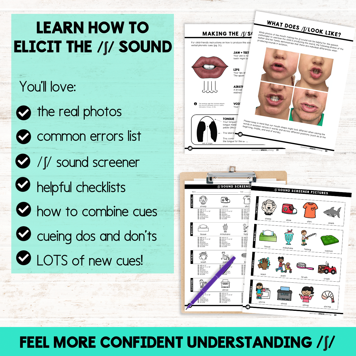 Sh Sound Therapy Guide for Childhood Speech