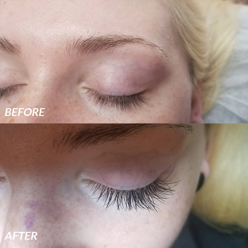 Lash Extension Before & After Advanced Esthetics LVC