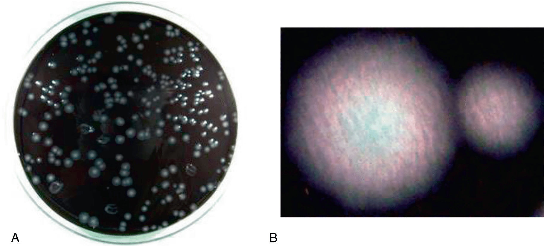 Legionella pneumophila