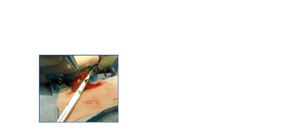 Veterinary Laser Surgical Vet CO2 Lasers Aesculight